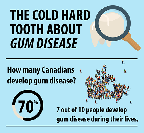 Gum Disease Infographic