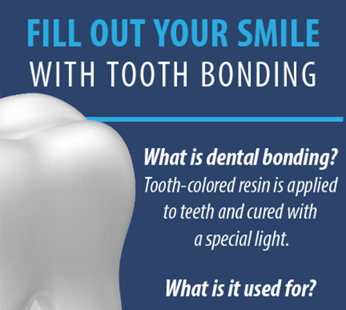 Dental Bonding Infographic