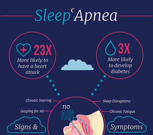 sleep-apnea-in-dansville-ny-dr-james-vogler