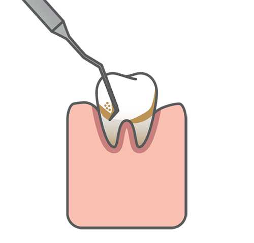 Scaling Illustration