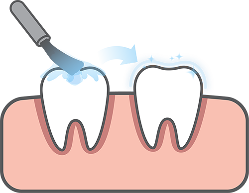 Sealants Illustration